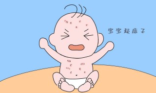 寶寶長痱子用什么擦好 這些都可以