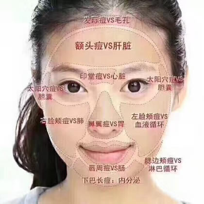 長痘痘的位置圖解代表了什么