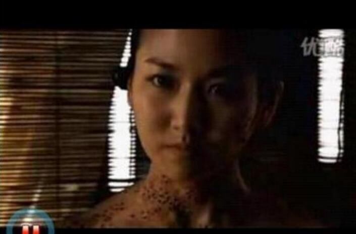 芝麻女孩惡心原圖 全是芝麻的恐怖圖片(容易引起不適)