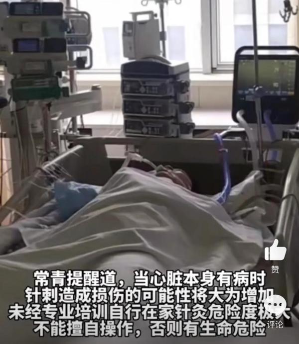 男子頭疼自己在家針灸扎破心臟