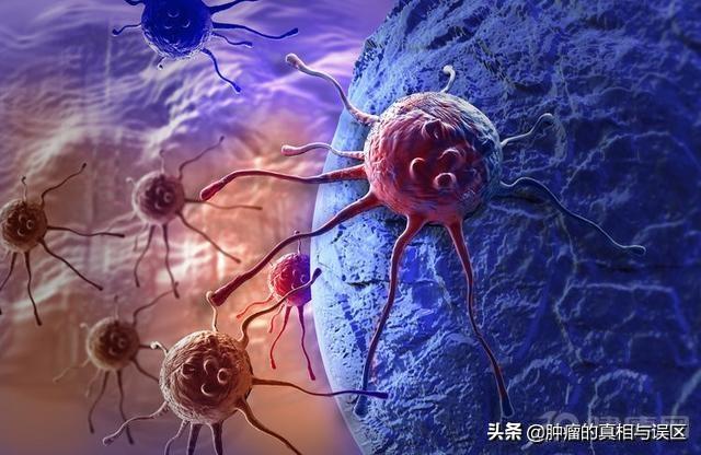 除癌別光想著“一刀切”！想提高生存率，就得早發現早治療