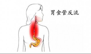 胃食管反流的兩大癥狀 美食面前不要太貪