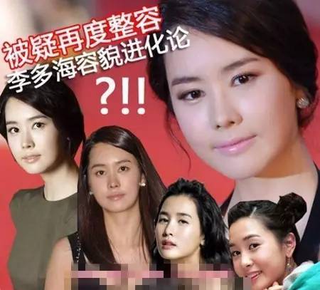 李多海整容前后圖片和個人資料及近況和圖片