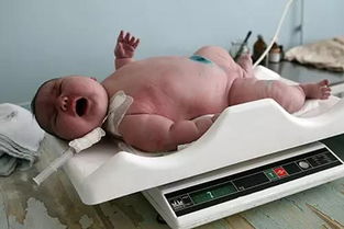 世界上出生最重的嬰兒，澳大利亞產婦誕下37斤巨嬰