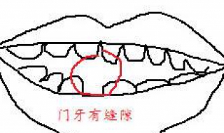 門牙中間有縫怎么辦 了解一下這些內容