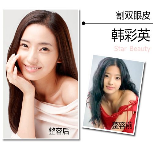 韓彩英整容前后對比圖片 韓彩英真的整容了嗎